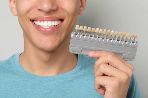 Facts About Dental Veneers