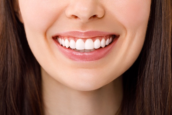 Reasons To Get Your Teeth Whitening Done By A Professional